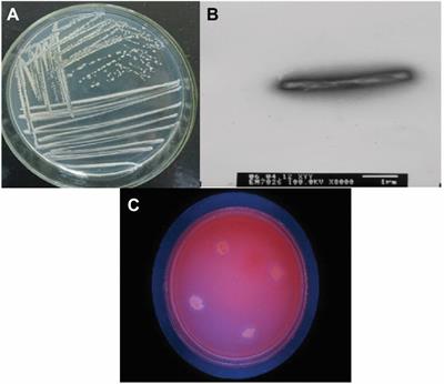 Screening and isolation of cold-adapted cellulose degrading bacterium: A candidate for straw degradation and De novo genome sequencing analysis
